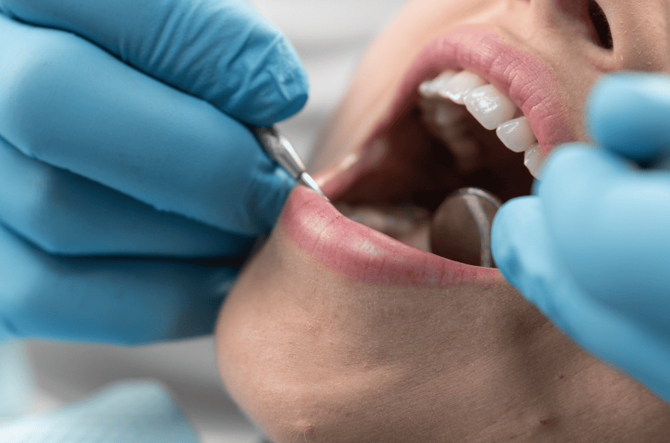 How Are Broken Teeth Treated?