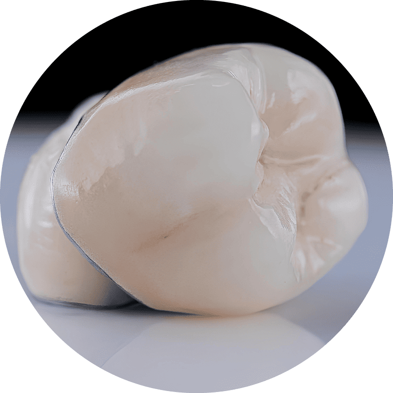 Dental Crowns