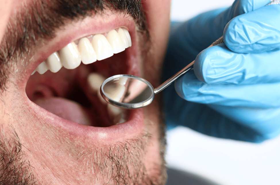 How Do Crowns Work?