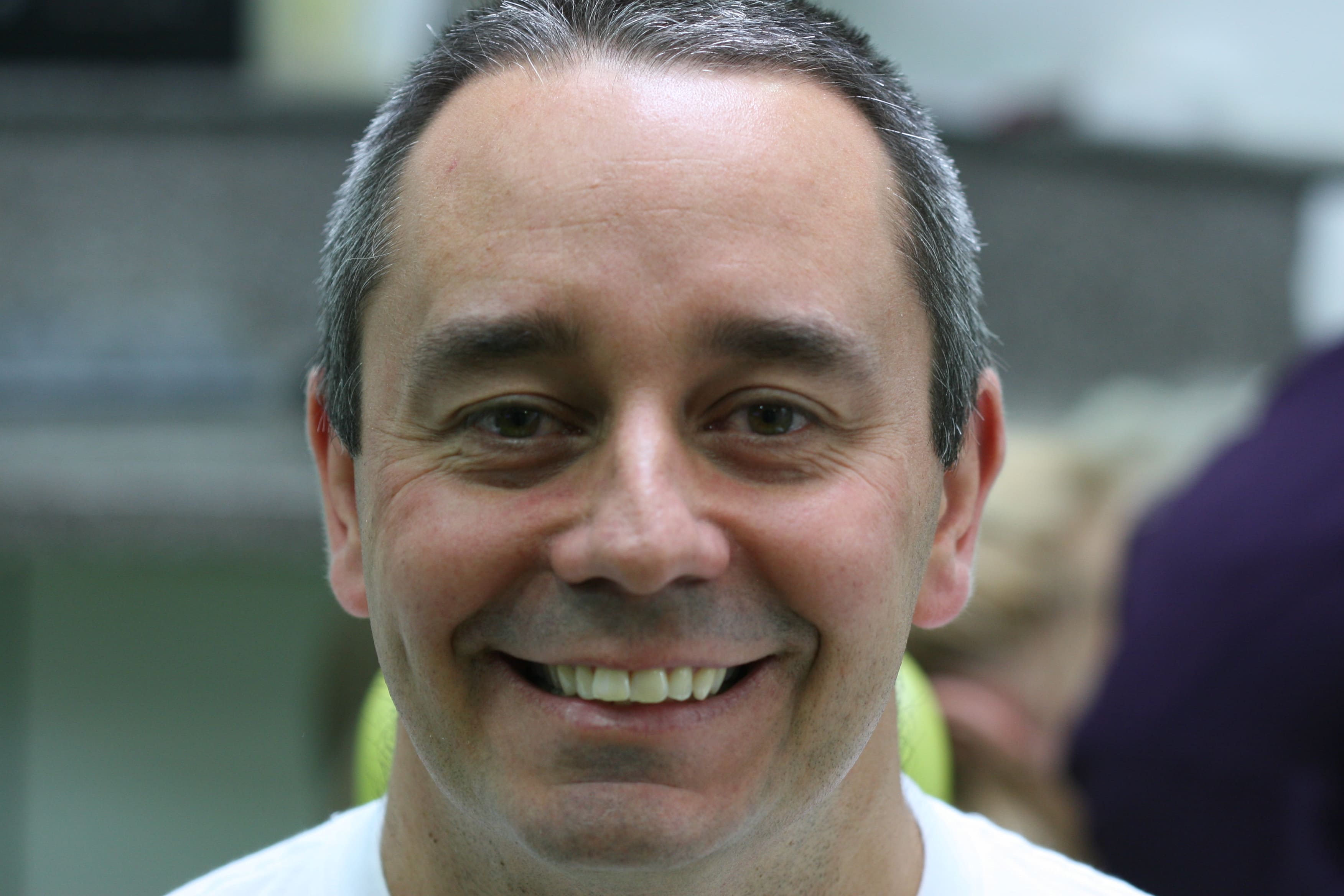 Six Month Smile - Before Treatment