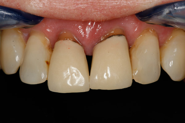 Unhappy Appearance - Before Treatment