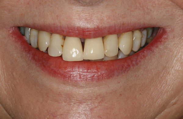 Unhappy Appearance - Before Treatment
