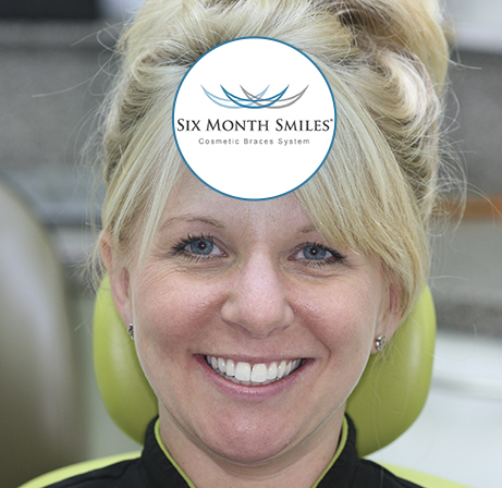 Claire 6 Month Smile Claire 6 Month Smile